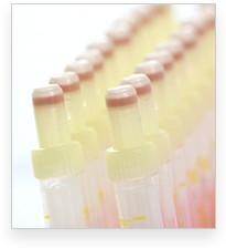 Eine Reihe von kleinen Plastik-Gefen.